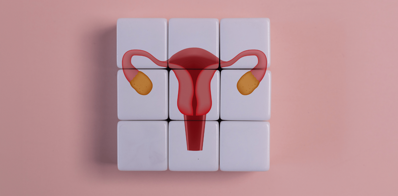 Blog post featured image